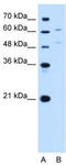 UDP Glucuronosyltransferase Family 1 Member A4 antibody, TA341883, Origene, Western Blot image 