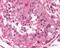 Melanoma-associated antigen 1 antibody, 49-710, ProSci, Immunohistochemistry frozen image 