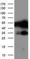 TAL BHLH Transcription Factor 1, Erythroid Differentiation Factor antibody, CF503898, Origene, Western Blot image 