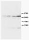 Bridging Integrator 1 antibody, AM20586PU-N, Origene, Western Blot image 