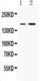DNA excision repair protein ERCC-6 antibody, PA5-79218, Invitrogen Antibodies, Western Blot image 