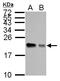 Adenine Phosphoribosyltransferase antibody, LS-C186084, Lifespan Biosciences, Western Blot image 
