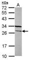 FGFR1 Oncogene Partner 2 antibody, GTX117894, GeneTex, Western Blot image 
