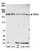 RPTOR Independent Companion Of MTOR Complex 2 antibody, A300-458A, Bethyl Labs, Western Blot image 
