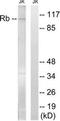 RB Transcriptional Corepressor 1 antibody, TA314427, Origene, Western Blot image 