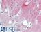L1 Cell Adhesion Molecule antibody, LS-B3433, Lifespan Biosciences, Immunohistochemistry frozen image 