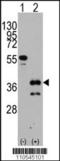 Zic Family Member 4 antibody, TA302374, Origene, Western Blot image 