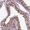 Chromosome 3 Open Reading Frame 70 antibody, PA5-59760, Invitrogen Antibodies, Immunohistochemistry frozen image 