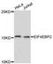 Eukaryotic Translation Initiation Factor 4E Binding Protein 2 antibody, LS-C748725, Lifespan Biosciences, Western Blot image 
