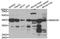 SWI/SNF-related matrix-associated actin-dependent regulator of chromatin subfamily B member 1 antibody, TA332899, Origene, Western Blot image 