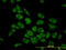 Histidyl-TRNA Synthetase antibody, LS-C197396, Lifespan Biosciences, Immunofluorescence image 