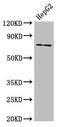 ATP Binding Cassette Subfamily G Member 5 antibody, CSB-PA863956LA01HU, Cusabio, Western Blot image 