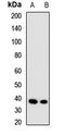 Aminolevulinate Dehydratase antibody, LS-C667760, Lifespan Biosciences, Western Blot image 