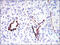 DLG Associated Protein 1 antibody, M08230, Boster Biological Technology, Immunohistochemistry paraffin image 