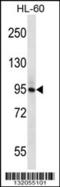 Phospholipase C Delta 1 antibody, 56-760, ProSci, Western Blot image 