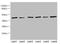 Tropomodulin 1 antibody, LS-C676609, Lifespan Biosciences, Western Blot image 