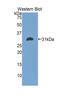 Electron transfer flavoprotein subunit alpha, mitochondrial antibody, LS-C293738, Lifespan Biosciences, Western Blot image 