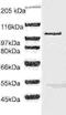 Disintegrin and metalloproteinase domain-containing protein 8 antibody, TA354545, Origene, Western Blot image 