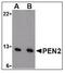 Presenilin Enhancer, Gamma-Secretase Subunit antibody, LS-B3207, Lifespan Biosciences, Western Blot image 