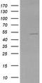 Zinc Finger And SCAN Domain Containing 21 antibody, TA506146AM, Origene, Western Blot image 