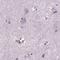 Dynein Axonemal Heavy Chain 12 antibody, PA5-63534, Invitrogen Antibodies, Immunohistochemistry frozen image 