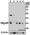 Serine/arginine-rich splicing factor 8 antibody, A13713, Boster Biological Technology, Western Blot image 