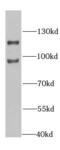 Interleukin Enhancer Binding Factor 3 antibody, FNab04288, FineTest, Western Blot image 