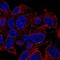 Plakophilin 4 antibody, NBP2-57367, Novus Biologicals, Immunocytochemistry image 