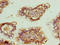 Zinc Finger Protein 281 antibody, LS-C395046, Lifespan Biosciences, Immunohistochemistry paraffin image 