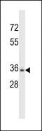 Chymotrypsin Like Elastase 3B antibody, PA5-48629, Invitrogen Antibodies, Western Blot image 