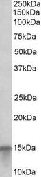 Protein S100-A7 antibody, GTX89325, GeneTex, Western Blot image 