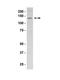 Nitric Oxide Synthase 3 antibody, LS-B8720, Lifespan Biosciences, Western Blot image 