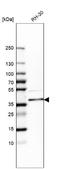 PDZ And LIM Domain 4 antibody, NBP1-80833, Novus Biologicals, Western Blot image 