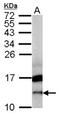 CXXC Repeat Containing Interactor Of PDZ3 Domain antibody, NBP2-14918, Novus Biologicals, Western Blot image 