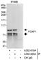Forkhead Box P1 antibody, A302-619A, Bethyl Labs, Immunoprecipitation image 