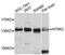 Neurotrophic Receptor Tyrosine Kinase 2 antibody, A2099, ABclonal Technology, Western Blot image 
