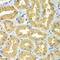 Golgi-associated PDZ and coiled-coil motif-containing protein antibody, LS-C349209, Lifespan Biosciences, Immunohistochemistry paraffin image 