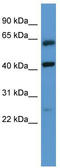 G Protein-Coupled Receptor Class C Group 5 Member B antibody, TA342742, Origene, Western Blot image 
