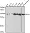 Replication Protein A2 antibody, A2189, ABclonal Technology, Western Blot image 