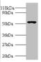 Glucagon-like peptide 1 receptor antibody, A53356-100, Epigentek, Western Blot image 