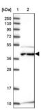 Chromosome 6 Open Reading Frame 47 antibody, NBP2-48828, Novus Biologicals, Western Blot image 