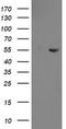 Chimerin 1 antibody, TA505096, Origene, Western Blot image 