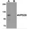 Vam6/Vps39-like protein antibody, MBS151418, MyBioSource, Western Blot image 