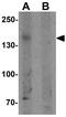 PH Domain And Leucine Rich Repeat Protein Phosphatase 2 antibody, GTX31862, GeneTex, Western Blot image 