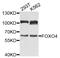 Forkhead Box O4 antibody, MBS129236, MyBioSource, Western Blot image 