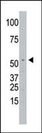 Signal Peptide Peptidase Like 2A antibody, 62-240, ProSci, Western Blot image 