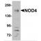 NLR Family CARD Domain Containing 5 antibody, MBS151554, MyBioSource, Western Blot image 