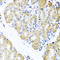 BCL2/adenovirus E1B 19 kDa protein-interacting protein 3-like antibody, LS-C334612, Lifespan Biosciences, Immunohistochemistry paraffin image 