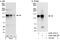 AXL Receptor Tyrosine Kinase antibody, A302-168A, Bethyl Labs, Immunoprecipitation image 