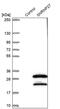 Small Nuclear Ribonucleoprotein U4/U6.U5 Subunit 27 antibody, PA5-56970, Invitrogen Antibodies, Western Blot image 